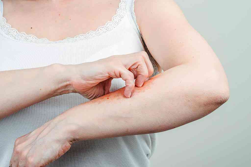 Why do wounds itch when they heal? | MirrorLog